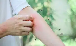 Eliminate Mosquitoes at Home